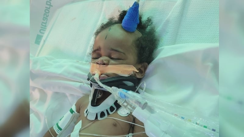2-year-old Tristan Barnes remains hospitalized after being wounded in a Wednesday night...